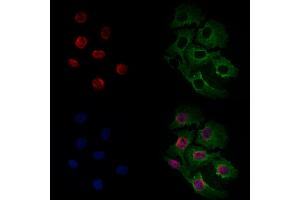 ABIN6261598 and ABIN6266535 staining Hela cells by IF/ICC. (ERK1/2 antibody  (C-Term))