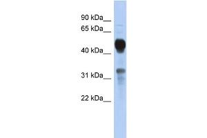 WB Suggested Anti-MVK Antibody Titration: 0. (MVK antibody  (Middle Region))