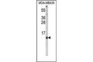 Western blot analysis of Hepcidin / HAMP Antibody (Center) in MDA-MB435 cell line lysates (35ug/lane). (Hepcidin antibody  (Middle Region))