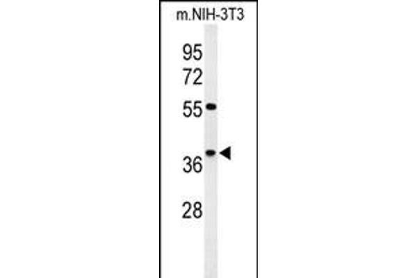 KLHDC2 antibody  (C-Term)