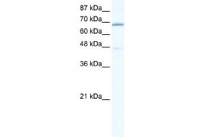 WB Suggested Anti-CACNB2 Antibody Titration:  0.