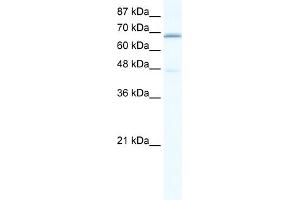 WB Suggested Anti-CACNB2 Antibody Titration:  0. (CACNB2 antibody  (C-Term))