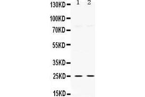 Western Blotting (WB) image for anti-Thymidine Kinase 1, Soluble (TK1) (AA 2-234) antibody (ABIN3042478) (TK1 antibody  (AA 2-234))