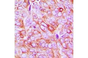 Immunohistochemistry (IHC) image for anti-Integrin beta 3 (ITGB3) (C-Term), (pTyr773) antibody (ABIN7300898)