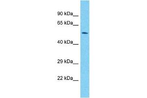 Host:  Rabbit  Target Name:  PAX7  Sample Type:  Fetal heart lysates  Antibody Dilution:  1. (PAX7 antibody  (C-Term))