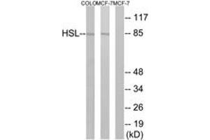 Western blot analysis of extracts from COLO/MCF7 cells, using HSL (Ab-552) Antibody.