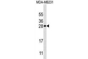 Western Blotting (WB) image for anti-Kallikrein 7 (KLK7) antibody (ABIN3002617) (Kallikrein 7 antibody)