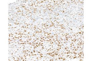 Immunohistochemistry (IHC) image for anti-Promyelocytic Leukemia (PML) (AA 375-425) antibody (ABIN7454722) (PML antibody  (AA 375-425))