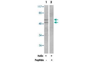 Western blot analysis of extracts from K-562 cells treated with H 2 O 2  (100 uM, 30 mins), using LYN polyclonal antibody . (CD180 antibody)