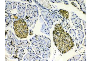 IHC analysis of HSPB8/Hsp22 using anti- HSPB8/Hsp22 antibody . (HSPB8 antibody  (AA 1-196))