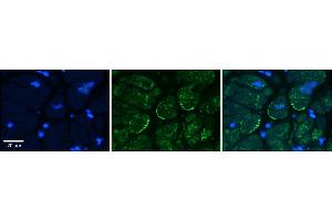 Rabbit Anti-ASPH Antibody    Formalin Fixed Paraffin Embedded Tissue: Human Adult heart  Observed Staining: Cytoplasmic, Membrane Primary Antibody Concentration: 1:600 Secondary Antibody: Donkey anti-Rabbit-Cy2/3 Secondary Antibody Concentration: 1:200 Magnification: 20X Exposure Time: 0. (Aspartate beta Hydroxylase antibody  (Middle Region))