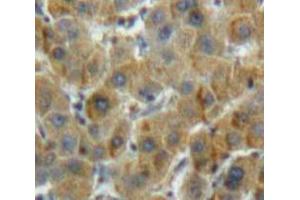 IHC-P analysis of Liver tissue, with DAB staining. (ALDH7A1 antibody  (AA 29-539))