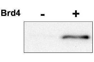Western blot using  affinity purified anti-CDK9 pT29 antibody shows detection of phosphorylated CDK9. (CDK9 antibody  (pThr29))