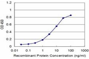 Detection limit for recombinant GST tagged ACAA2 is approximately 0. (ACAA2 antibody  (AA 151-260))