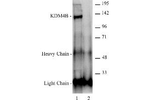 JMJD2B / KDM4B antibody (pAb) tested by Immunoprecipitation. (KDM4B antibody  (C-Term))