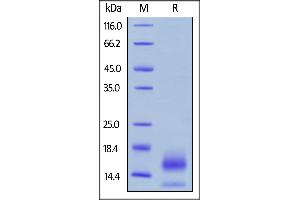 Biotinylated Human BCMA, His,Avitag on  under reducing (R) condition.