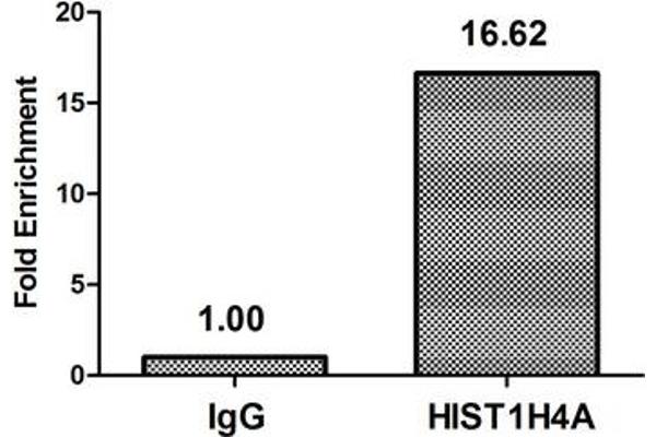 HIST1H4A antibody  (acLys31)