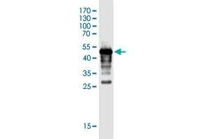 Western Blot detection against Immunogen (44. (FLJ35767 (AA 1-164) antibody)