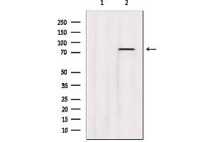 Western blot analysis of extracts from B16F10, using ABCD3 Antibody.