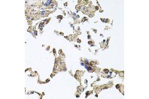 Immunohistochemistry (Paraffin-embedded Sections) (IHC (p)) image for anti-Protein Kinase N1 (PKN1) (AA 1-300) antibody (ABIN1682293)