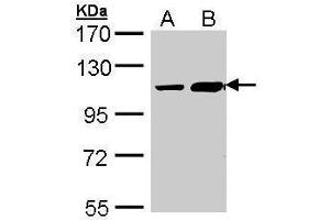 WB Image Sample (30 ug of whole cell lysate) A: Hep G2 , B: Molt-4 , 7. (TRAK2 antibody  (C-Term))