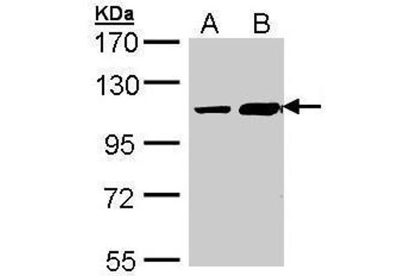 TRAK2 anticorps  (C-Term)