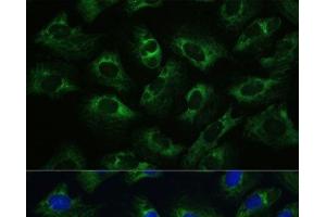 Immunofluorescence analysis of U-2 OS cells using Polyclonal AntibodyPC1 Polyclonal Antibody at dilution of 1:100 (40x lens). (PC1 antibody)