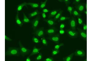 Immunofluorescence analysis of A549 cells using APTX antibody (ABIN5973100). (Aprataxin antibody)