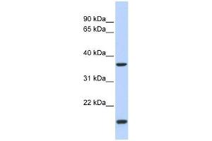 ZIC4 antibody used at 0. (ZIC4 antibody  (N-Term))