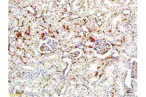 Formalin-fixed and paraffin embedded rat kidney labeled with Rabbit Anti APOA2 Polyclonal Antibody, Unconjugated (ABIN708686) at 1:200 followed by conjugation to the secondary antibody and DAB staining
