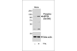 Western blot analysis of lysates from Hela cell line, untreated or treated with T, 200nM, using (ABIN6241062 and ABIN6578958) (upper) or Beta-actin (lower). (EEF2K antibody  (pSer366))