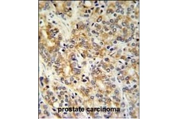 TXNDC12 antibody  (C-Term)