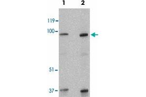 Western blot analysis of SKI in human kidney tissue lysate with SKI polyclonal antibody  at 1 and 2 ug/mL .