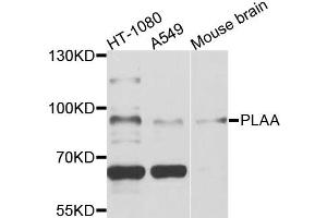 Western blot analysis of extracts of various cell lines, using PLAA antibody (ABIN5972403) at 1/1000 dilution. (PLAA antibody)