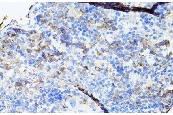 TEFM antibody