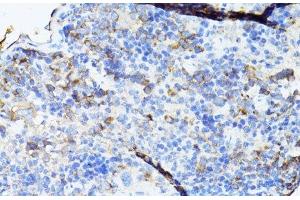 Immunohistochemistry of paraffin-embedded Mouse spleen using TEFM Polyclonal Antibody at dilution of 1:100 (40x lens).