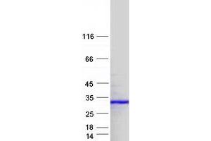 Validation with Western Blot