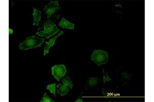 Immunofluorescence of monoclonal antibody to LEPRE1 on HeLa cell. (LEPRE1 antibody  (AA 1-100))