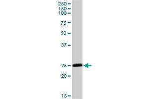 MSRA MaxPab rabbit polyclonal antibody. (MSRA antibody  (AA 1-235))