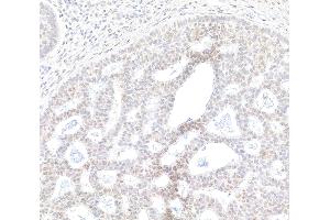 anti-Bromodomain Containing 2 (BRD2) (AA 675-725) antibody