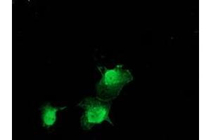 Anti-ZFAND2B mouse monoclonal antibody (ABIN2454250) immunofluorescent staining of COS7 cells transiently transfected by pCMV6-ENTRY ZFAND2B (RC203822). (ZFAND2B antibody)