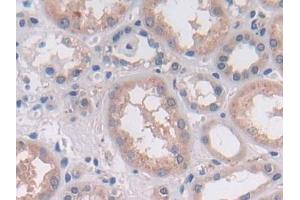 DAB staining on IHC-P; Samples: Human Kidney Tissue (OAS2 antibody  (AA 11-346))