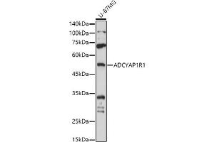 Western blot analysis of extracts of U-87MG cells, using R1 antibody (ABIN3023489, ABIN3023490, ABIN3023491 and ABIN6220077) at 1:1000 dilution. (ADCYAP1R1 antibody)