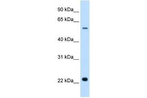 Solute Carrier Family 17 (Acidic Sugar Transporter), Member 5 (SLC17A5) antibody