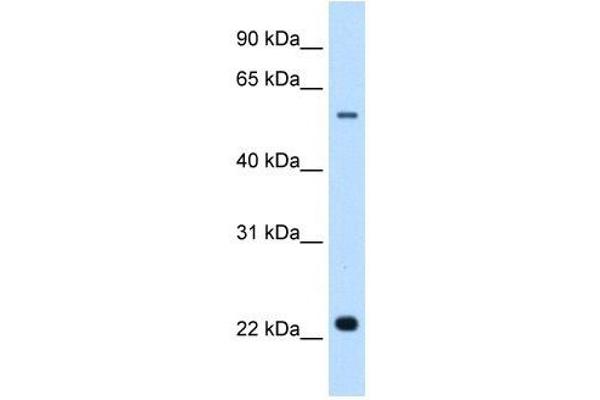 Solute Carrier Family 17 (Acidic Sugar Transporter), Member 5 (SLC17A5) antibody