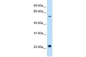 SLC17A5 antibody used at 0. (Solute Carrier Family 17 (Acidic Sugar Transporter), Member 5 (SLC17A5) antibody)