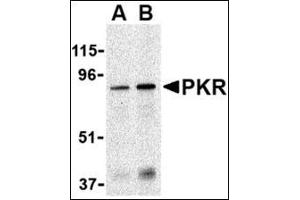 Western blot analysis of PKR in Caco-2 whole cell lysate with this product at (A) 1 and (B) 2 μg/ml.