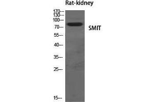 Western Blot (WB) analysis of specific cells using SMIT Polyclonal Antibody. (SLC5A3 antibody  (Internal Region))