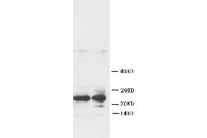 Anti-FGF8 antibody, Western blottingWB: Rat Ovary Tissue Lysate (FGF8 antibody  (C-Term))