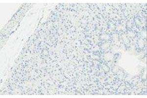 Immunohistochemistry (IHC) image for anti-TLR4 /MD2 Complex antibody (ABIN2665420) (TLR4 /MD2 Complex antibody)